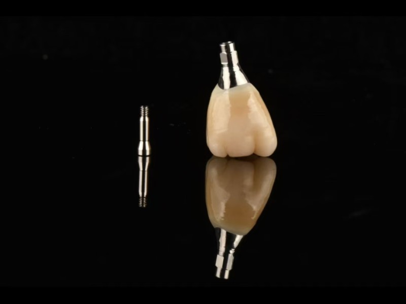 Dental implant